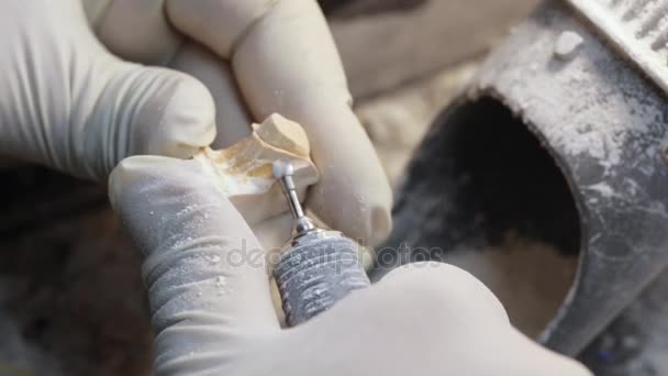 Ceramet implant schepsel proces in laboratorium. — Stockvideo
