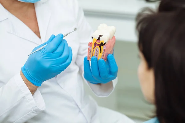 APRSWXNET stomatologa z modelu zębów — Zdjęcie stockowe
