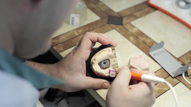 Proceso de criatura de implante de Ceramet en laboratorio . — Vídeo de stock