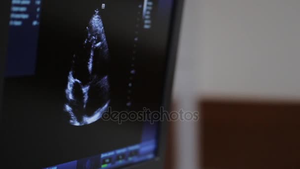 Ultrasound examination of heart. Monitor screen extreme close up. — Stock Video