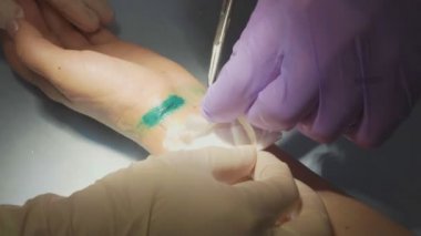 Yakın çekim doktor dikişler bandaj kol Bayan hasta kaldırır.
