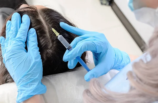 Doctor in clinic cosmetic injections into the scalp for hair growth — Stock Photo, Image