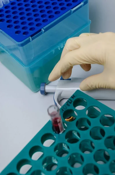 Bilim, kimya, biyoloji, tıp ve insan konsepti - klinik laboratuarında araştırma yapan, kan örneğiyle test tüpü tutan genç kadın bilim adamına yakın çekim
