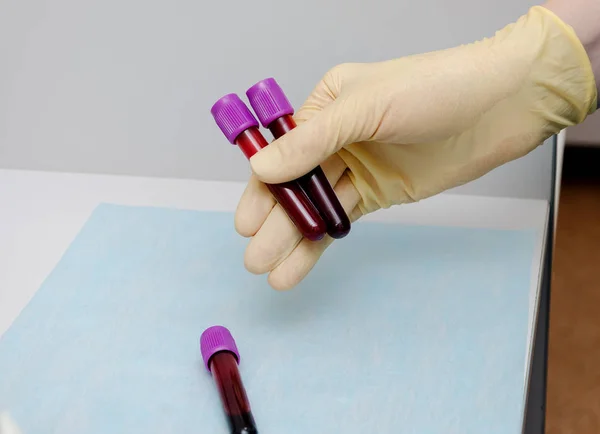 Hand holding test tube with blood plasma ready for testing — Stock Photo, Image