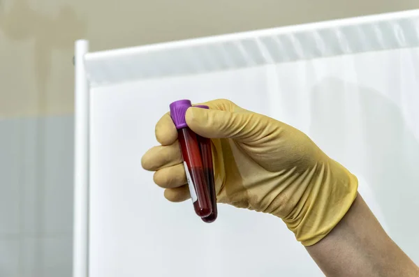 Hand holding test tube with blood plasma ready for testing — Stock Photo, Image