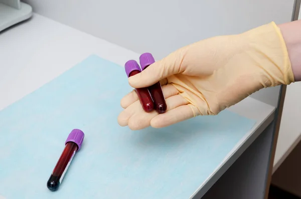 Hand holding test tube with blood plasma ready for testing — Stock Photo, Image