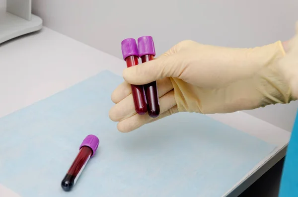 Hand haltenden Reagenzglas mit Blutplasma bereit für den Test lizenzfreie Stockfotos