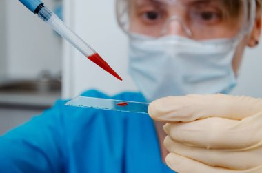Laboratuvar asistanı kan örneğini analiz ediyor.