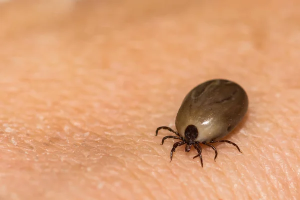 Engorged Female Deer Tick Removed Accidental Host — Stock Photo, Image