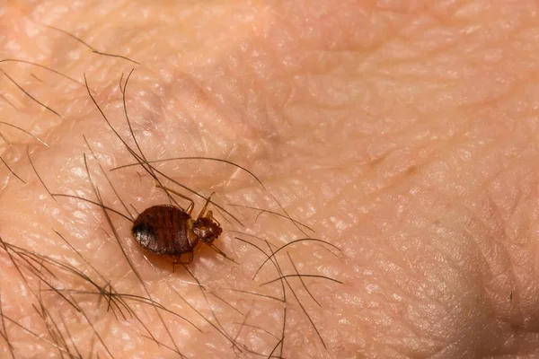 Zbliżenie Common Bed Bug Cimex Lectularius — Zdjęcie stockowe