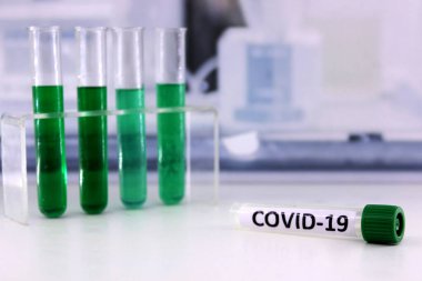 Bilim adamı Covid-19 aşısını arıyor.