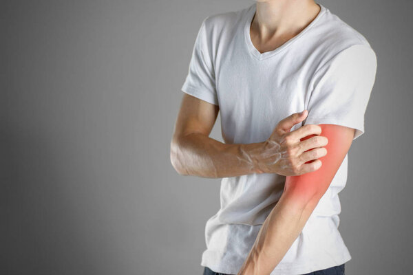 Guy in white shirt scratching his arm. Scabies. Scratch the hand