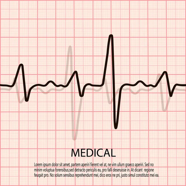 Kardiologi koncept med pulsdiagram. Medicinsk bakgrund med hjärta kardiogram. — Stock vektor