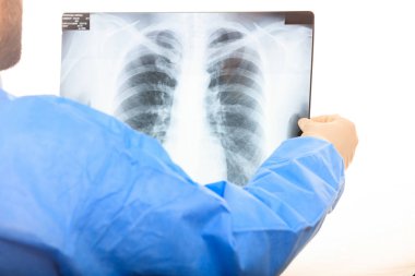 Doktor xrays arıyorsunuz