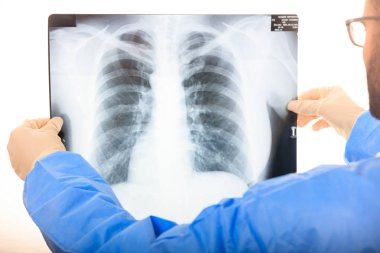 Doktor xrays arıyorsunuz