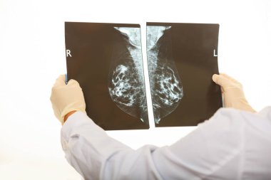 Bir mamografi beyaz arka plan üzerinde tutan doktor
