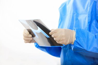 Bir mamografi beyaz arka plan üzerinde tutan doktor