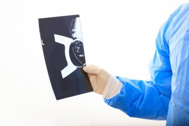 Bir mamografi beyaz arka plan üzerinde tutan doktor