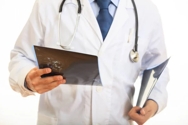 Médico segurando uma mamografia em fundo branco — Fotografia de Stock