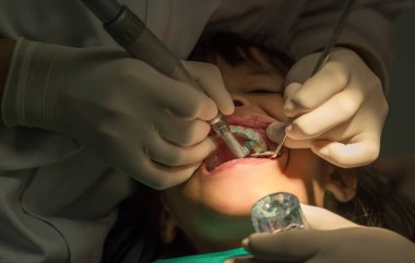 Diş çıkarma sırasında genç Asyalı kız
