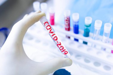 Coronavirus covid-19 virüsü tıbbi test tüpü, salgın aşısı