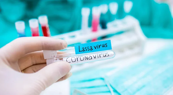 Kéz Kesztyűben Tartó Orvosi Kémcsövek Felirattal Lassa Vírus Koronavírus Pandémiás — Stock Fotó