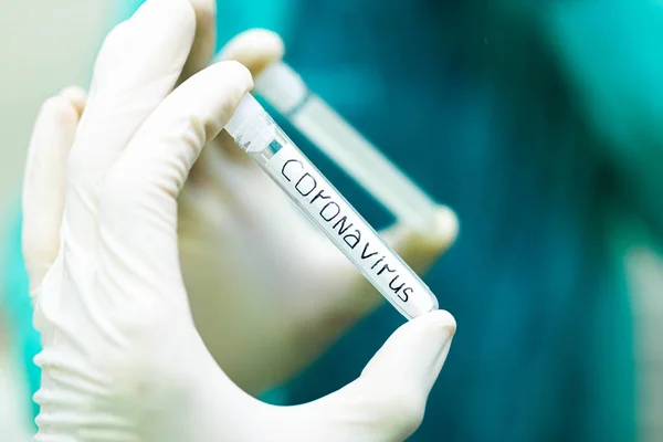 Hand Hand Mit Medizinischem Reagenzglas Mit Der Aufschrift Coronavirus Pandemisches — Stockfoto