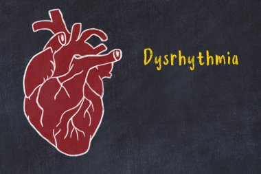 Siyah masadaki insan kalbinin tebeşir çizimi ve yazıt düzensizliği
