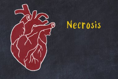 Kardiyovasküler sistemi öğrenme kavramı. İnsan kalbinin tebeşir çizimi ve Nekroz.