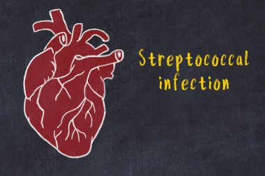 Learning cardio system concept. Chalk drawing of human heart and inscription Streptococcal infection clipart