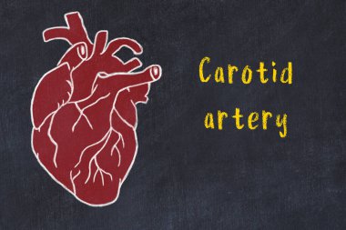 İnsan kalbinin kara masa ve karotid arter üzerindeki tebeşir çizimi