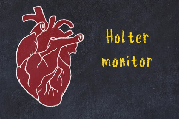 Concetto di apprendimento del sistema cardiovascolare. Gesso disegno del cuore umano e iscrizione Holter monitor — Foto Stock