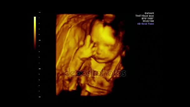 Ultraschall eines schönen Babys — Stockvideo