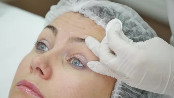 医師がクリニックで顔の整形手術の患者の顔にマーカーで線を描く — ストック動画