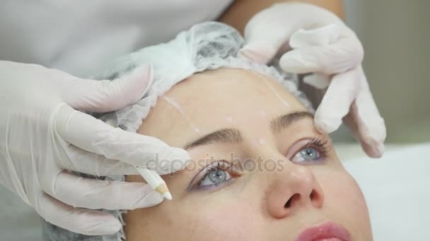 Dokter tekent lijnen met marker op patiënt gezicht voor gezicht plastische chirurgie in kliniek — Stockvideo