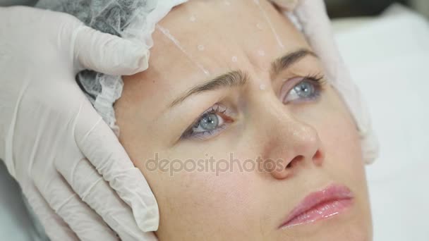 Doctor draw lines with marker on patient face for facial plastic surgery at clinic — Stock Video