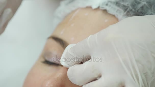 医師がクリニックで顔の整形手術の患者の顔にマーカーで線を描く — ストック動画