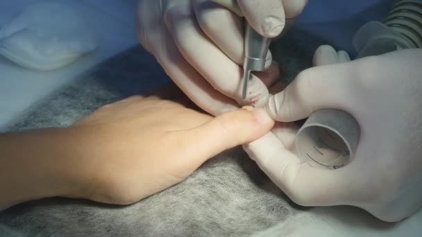 Доктор вводит анестетик в руку. . — стоковое видео