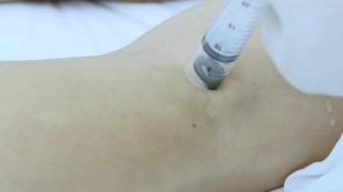 Hirudotherapy Kliniği - sülük deri kadın