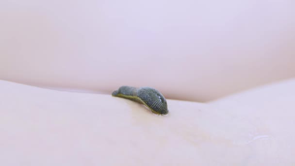 Hirudotherapy in clinic - Leech on skin of woman — Stock Video