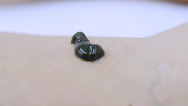 Hirudothérapie en clinique - Sangsue sur la peau de la femme 