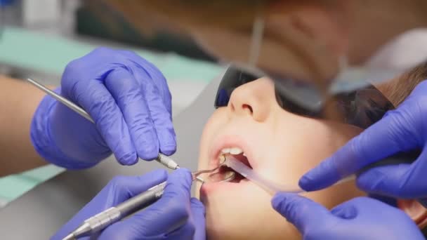 Primer plano niño pequeño durante el procedimiento de tratamiento de perforación de dientes en el consultorio de la clínica dentista — Vídeo de stock
