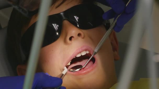 Gros plan petit enfant pendant la procédure de perçage des dents traitement au cabinet de la clinique dentaire — Video