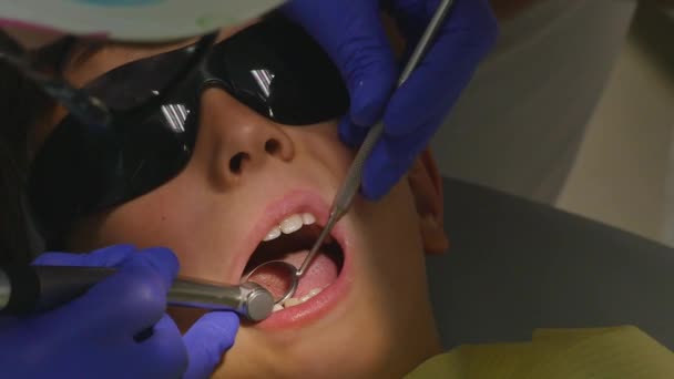 Primer plano niño pequeño durante el procedimiento de tratamiento de perforación de dientes en el consultorio de la clínica dentista — Vídeos de Stock