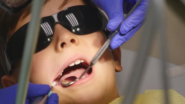 Крупним планом маленька дитина під час процедури буріння зубів в кабінеті стоматолога — стокове відео