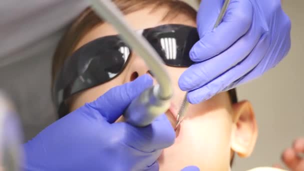 Gros plan petit enfant pendant la procédure de perçage des dents traitement au cabinet de la clinique dentaire — Video