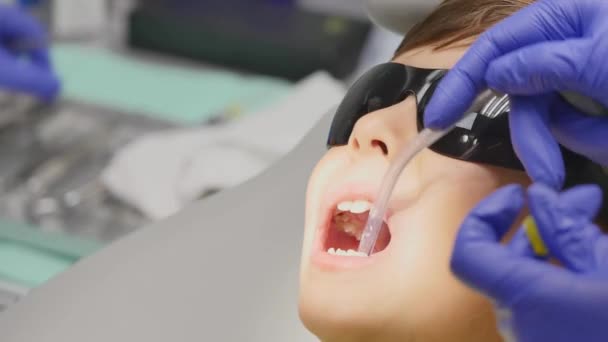 Primer plano niño pequeño durante el procedimiento de tratamiento de perforación de dientes en el consultorio de la clínica dentista — Vídeos de Stock