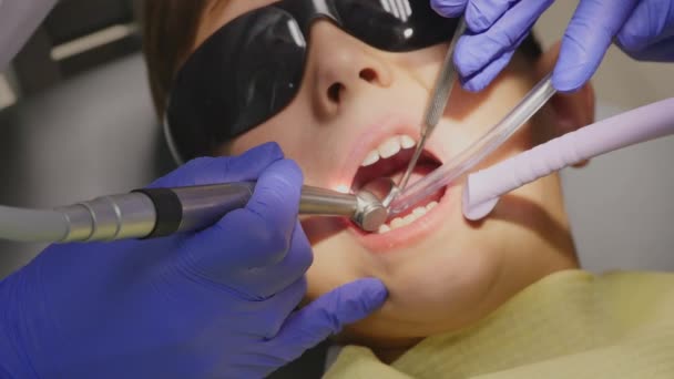 Primer plano niño pequeño durante el procedimiento de tratamiento de perforación de dientes en el consultorio de la clínica dentista — Vídeos de Stock