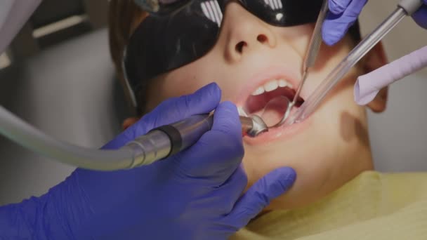 Closeup λίγο παιδί κατά τη διάρκεια της διαδικασίας των δοντιών γεωτρήσεων θεραπεία σε κλινική ΟΔΟΝΤΙΑΤΡΕΙΟ — Αρχείο Βίντεο