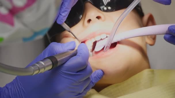 Gros plan petit enfant pendant la procédure de perçage des dents traitement au cabinet de la clinique dentaire — Video